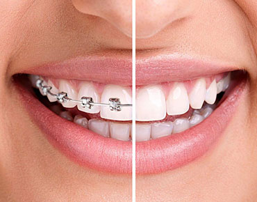 White Pearl Dental Care - Multi-Speciality Dentistry